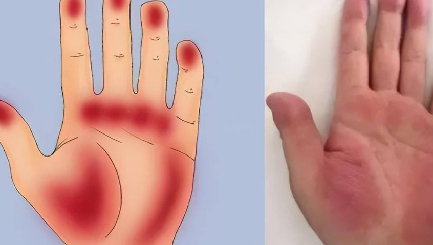 肝病前期不痛不痒如何识别？肝病警惕这些预警信号！