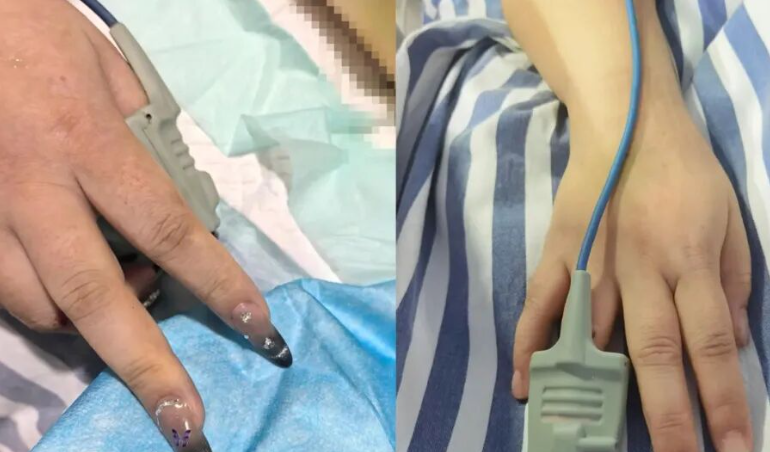 女子心跳骤停美甲阻碍抢救 医生提醒美甲风险 女子心跳骤停美甲阻碍抢救 医生提醒美甲风险