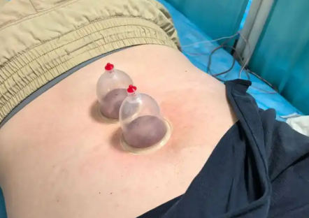 节后门诊爆满减肥“神器”火了!火爆的减肥“神器”人人能用吗? 节后门诊爆满减肥“神器”火了!火爆的减肥“神器”人人能用吗?