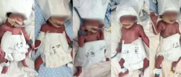 24岁女子成功诞下5胞胎 5胞胎六千万分之一概率的奇迹！