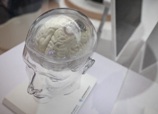 首款侵入式脑机接口医疗器械上市 可辅助实现手部抓握功能代偿