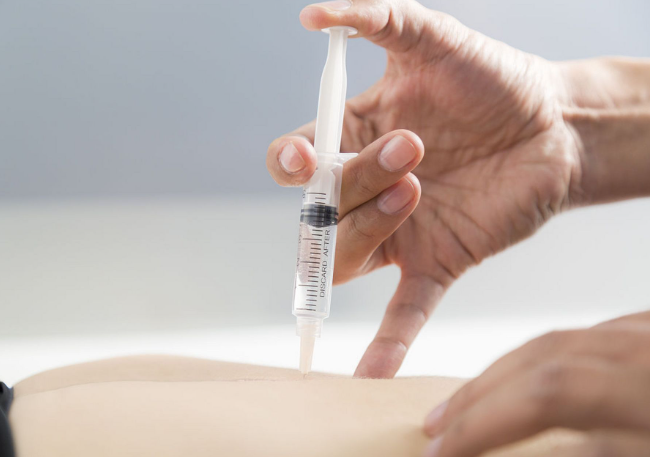 小时候流行的“屁股针”消失了吗?肥胖时代的打针困难有哪些?