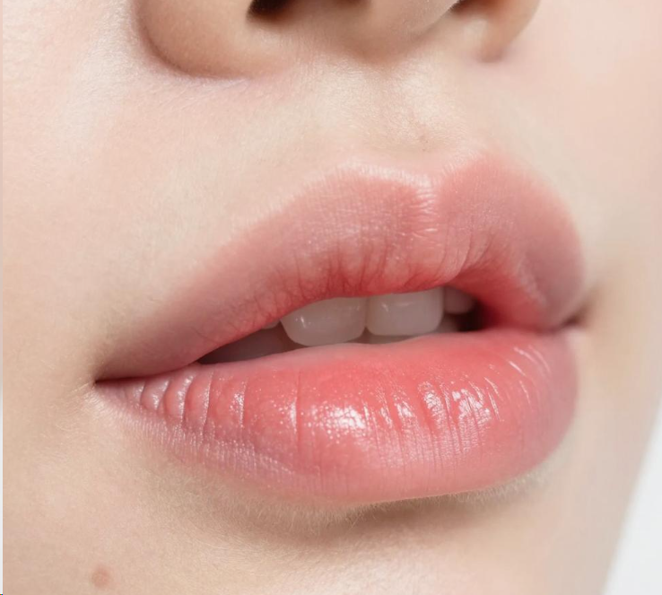 嘴唇发紫博主被粉丝隔空诊出心脏病 2026年32岁博主嘴唇发紫被粉丝催检查