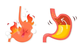 胃食管反流烧心反酸怎么办，胃食管反流学会自救