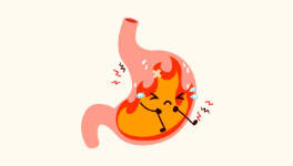 胃食管反流烧心反酸怎么办，胃食管反流学会自救