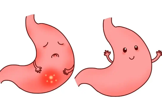 这些高危人群建议尽早做胃镜 越来越多的年轻人被胃病困扰