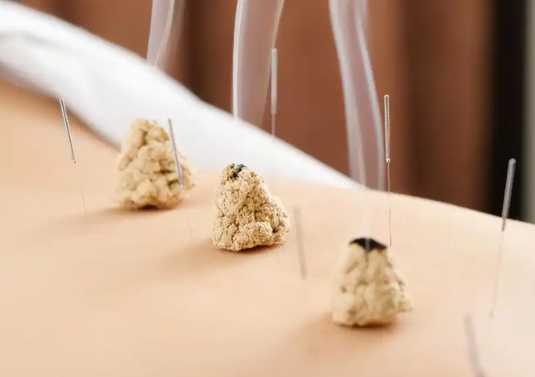 晚上能做艾灸吗 晚上做艾灸药注意什么