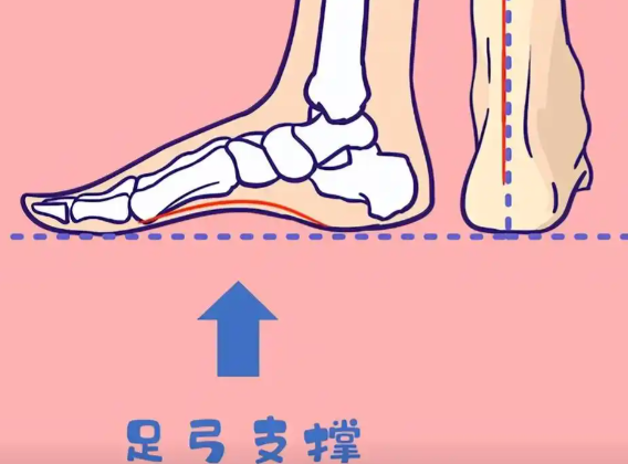 扁平足怎么矫正？ 从几岁开始预防扁平足效果最好