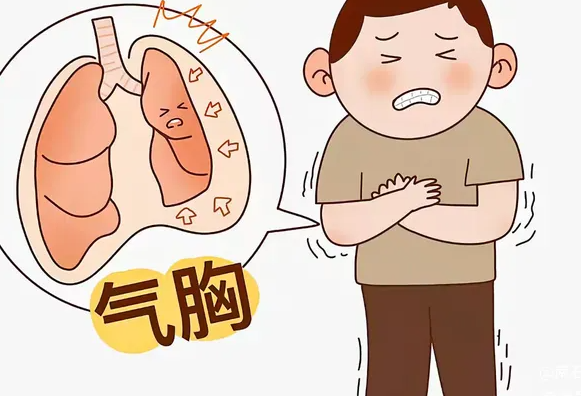 19岁男主播喊麦后右肺几乎“消失” 引发气胸的原因可能有哪些