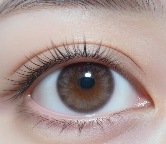 眼压正常也有可能是青光眼？ 2026视力有1.0就没有青光眼？