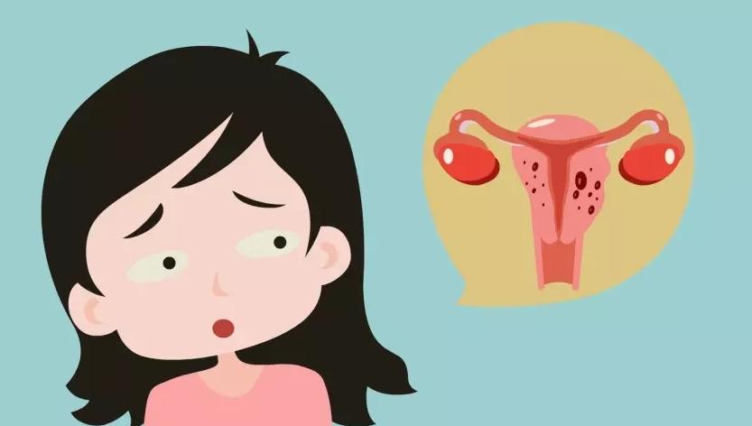 子宫肌瘤有哪些危害？子宫肌瘤容易引起的并发症