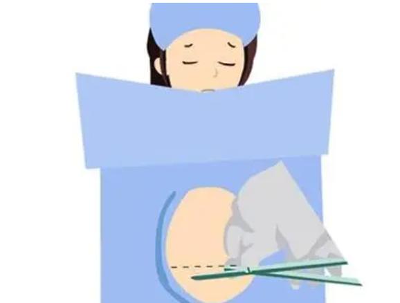 孕妇剖腹产前需要做哪些准备？孕妇剖腹产前注意事项有哪些？