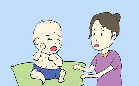 宝宝为何湿疹高发？可能家里人有这种疾病，记住不要随便涂药膏