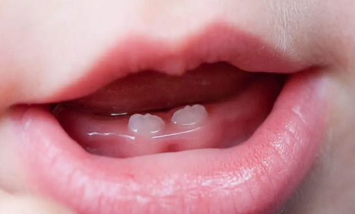 婴儿长牙前有哪些症状(婴儿长牙会引起发烧吗)