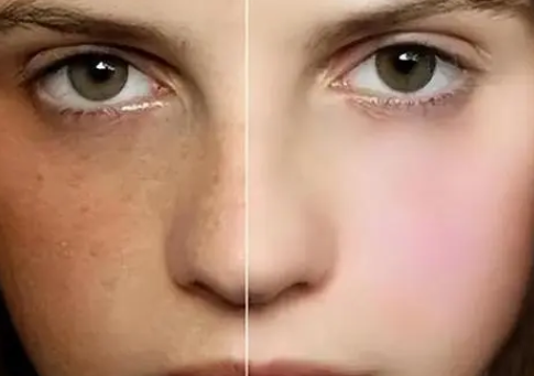 皮肤暗沉发黄怎么办？助你撕掉“黄脸婆”标签！