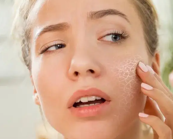 护肤心得|不想让脸垮掉，那你必须知道这个！