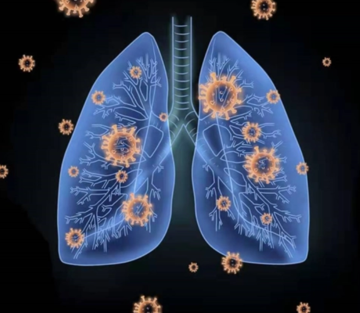 退烧后小心白肺导致呼吸衰竭(退烧后呼吸不畅是白肺吗)