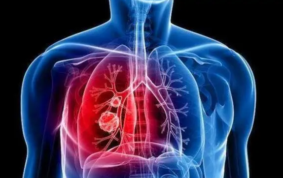 退烧后小心白肺导致呼吸衰竭(退烧后呼吸不畅是白肺吗)